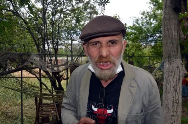 Komşu kavgası! Tiyatrocu Cemal Uçarman'ın yüzüne keserle saldırdı ağzına vurup 3 dişini kırdı
