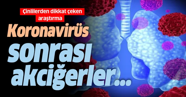 Koronavirüsün akciğere etkileri neler? İyileşen koronavirüs hastalarının akciğerleri hakkında çarpıcı araştırma!