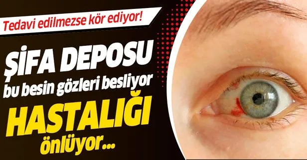Gozun Sifasi Onda Yaban Mersini Mucizesi Takvim