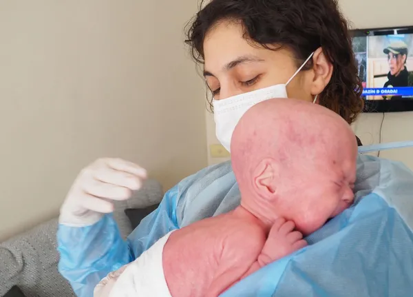 300-milyonda-bir-gorulen-yilan-hastaligi-harlequin-tipi-iktiyozis-ile-dogan-gokdeniz-bebek-1-yasinda-gunde-1-k-1644303245515.jpg 300 milyonda bir görülen yılan hastalığı (Harlequin tipi iktiyozis) ile doğan Gökdeniz Bebek 1 yaşında! Günde 1 kilo vazelin 2 tüp krem bitiyor-6