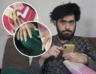 Her şey depremden sonra başladı! Ne dışarı çıkıyor ne yıkanıyor! Telefon bağımlısı Barış Özbay şaşkına çevirdi