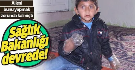 Sağlık Bakanlığı, ısırmasın diye ellerine pet şişe geçirilen küçük Yusuf için harekete geçti!