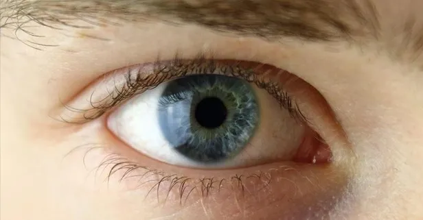 FDA’dan çift odaklı gözlüklere alternatif: VIZZ göz damlasına onay