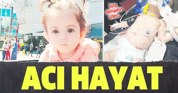 1 yaşındaki Suriyeli Hayat Neccar bebek işkenceyle öldürüldü! İşte dehşetin izleri