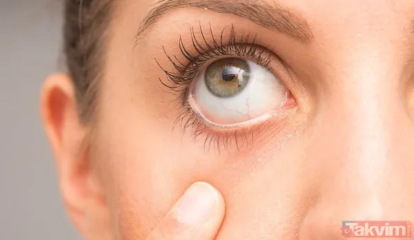 İçi de dışı da sizi yakar! Hepimiz sağlıklı sanıyoruz ama yavaş yavaş zehirleniyormuşuz! Her yediğinizde adım adım... - 5