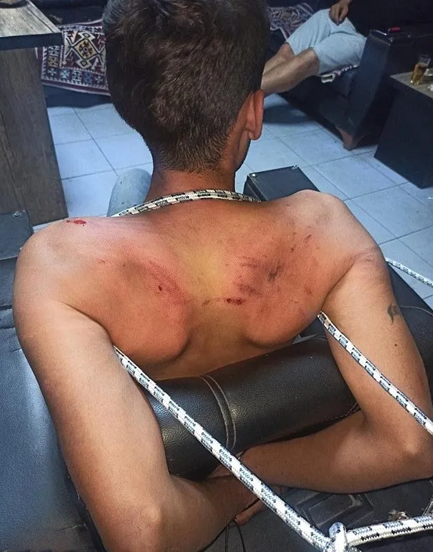 3-gun-boyunca-acimasiz-eziyet-hamam-bocegi-yedirdiler-iskence-ettiler-canilerin-cezasi-belli-oldu-1765272247242.jpeg Vedat Kurt (İHA)