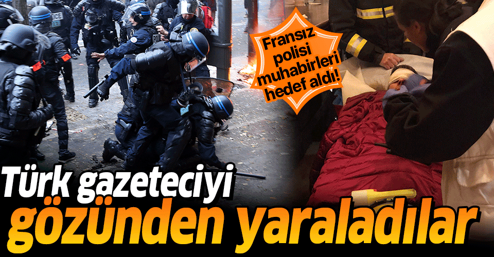 Paris'te polisin attığı gaz kapsülü Türk foto muhabirini yaraladı