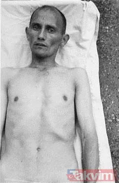 Dachau'nun Buzlu Suları Ve Yüksek Basınç Odaları Sistematik Vahşetin En Somut Örneklerinden Bazıları Dachau Toplama Kampında Yaşandı. Ss Doktoru Sigmund Rascher...