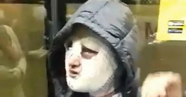 Korkunç olay! Eski sözlüsüne önce tecavüz etti sonra yüzüne kızgın yağ döktü!
