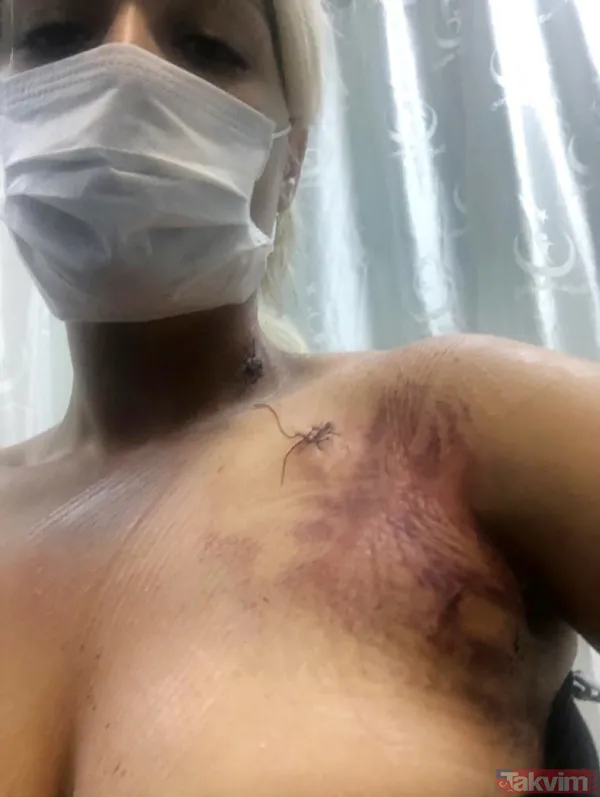 Erkek arkadaşı ensesinden vurdu! Genç kadının ilk duruşma öncesi yardım çığlığı - 7