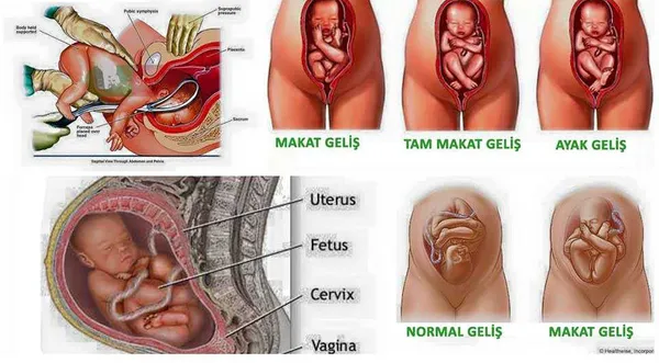 ters-dogum-nedir-dogum-kocu-evde-dogum-yaptirdi-ters-gelen-bebek-oksijensizlikten-oldu-1641992783689.jpg Ters doğum nedir? Doğum koçu evde doğum yaptırdı! Ters gelen bebek oksijensizlikten öldü-8