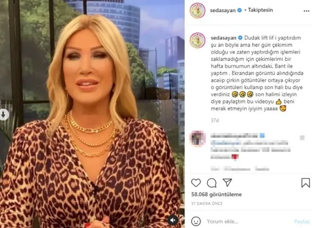 Seda Sayan’ın dudaklarına ne oldu? Gelinim Mutfakta sunucusu Seda Sayan estetik mi yaptırdı? Açıklama geldi…-2
