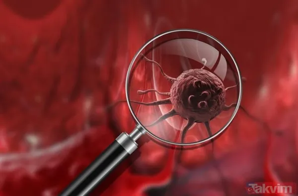 Ağız kokusu kanserin habercisi - 19