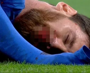 Messi kanlar içinde yerde! El Clasico çok konuşulacak