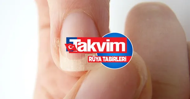 Rüyada tırnağın etten ayrılmasının anlamı, yorumu - Rüyada tırnak kırılması ne anlama gelir, neye işarettir?