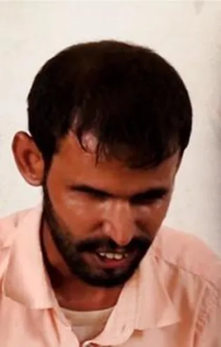 Genetik bozukluk Yemen'de bir köyü kör etti