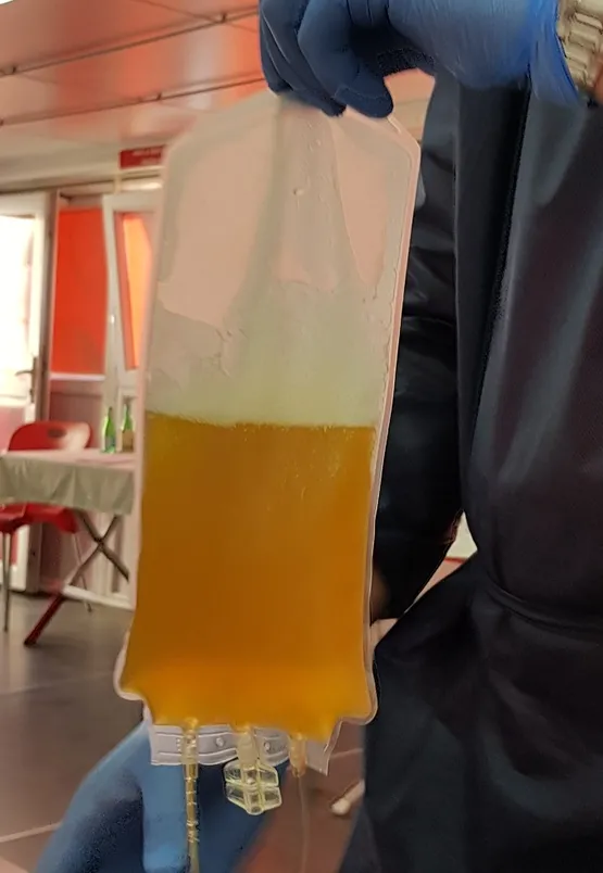 coronavirusu-kovid-19-yenen-35-yasindaki-ayten-sevil-plazma-bagisinda-bulundu-1587589398003.jpg Coronavirüsü (Kovid-19) yenen 35 yaşındaki Ayten Sevil plazma bağışında bulundu-2