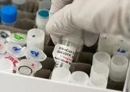 Son dakika: ABDdeki yeni araştırmaya göre D vitamini eksikliği Kovid-19dan ölüm riskini artırabilir