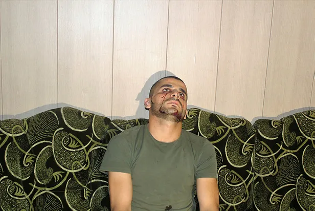 23 yaşındaki Iraklı genç iki aydır kan ağlıyor-2