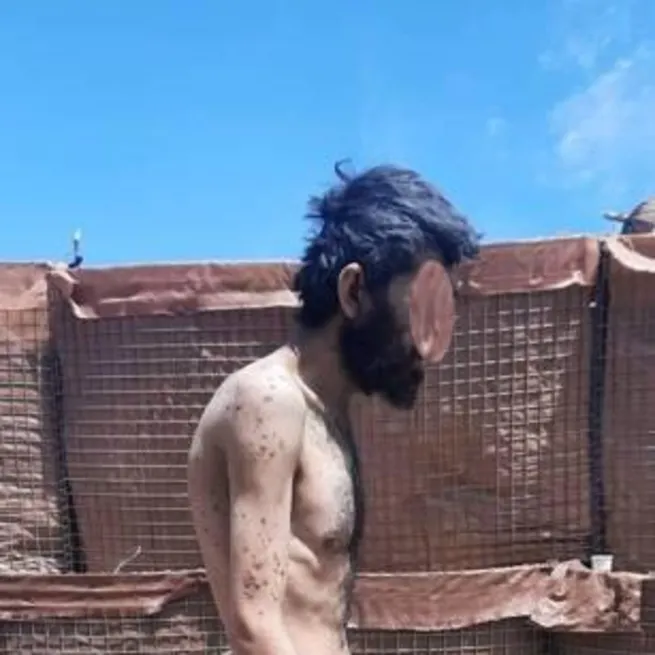 Teslim olan PKKlı teröristlerin sefil görüntüleri ortaya çıktı... Elebaşları sefa alt kademe sefalet içinde!