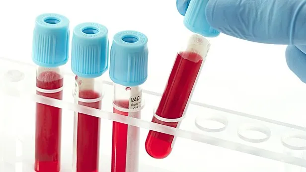 Kordon Kani Nedir Kordon Kani Saklama Ne Ise Yarar Takvim