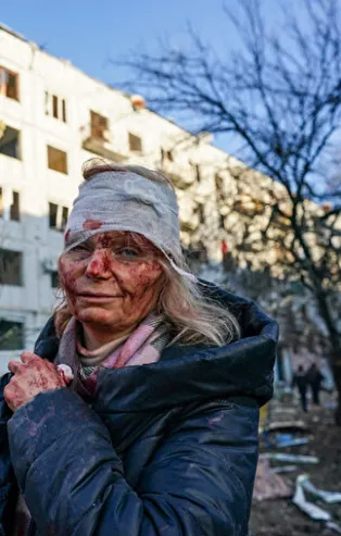 Rusya-Ukrayna savaşının simgesi olan Olena Kurilo bakın şimdi ne yapıyor!