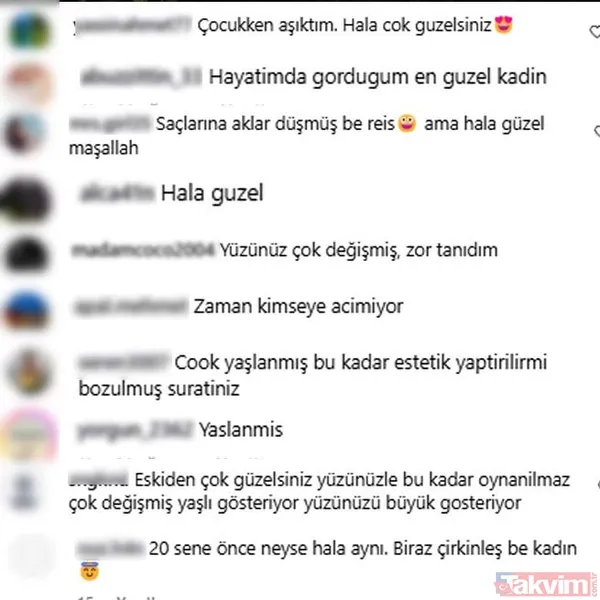 1996 güzeli Tuğba Altıntop’un son hali sosyal medyayı ikiye böldü: “Bu kadar estetik yaptırılır mı? Bozulmuş suratınız” - 7