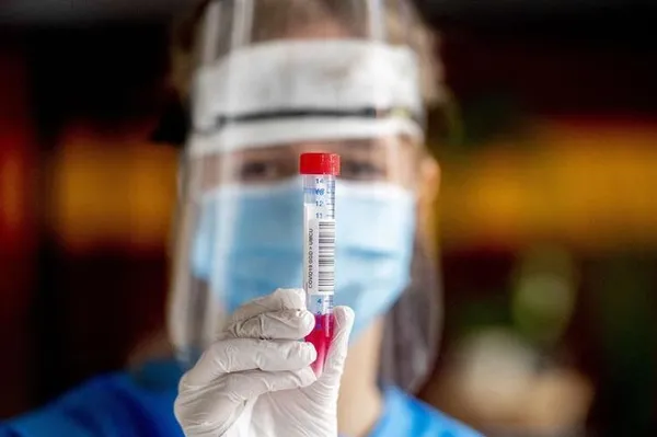 Doktorlar bile şaştı kaldı! 1,5 ay arayla ikinci kez koronavirüs testi pozitif çıktı-2