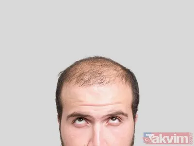 sac dokulmesi neden olur