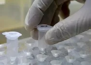 Filyasyon ne demek? Filyasyon ekibi ne iş yapar? Filyasyon nasıl yapılıyor?