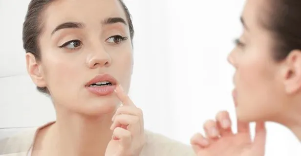 Stres, yorgunluk, kilo kaybı, uykusuzluk gibi birçok neden çıkan uçuğun kesin tedavisi bulunmuyor | Sağlık haberleri