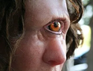 Rüyada tek göz görmek ne anlama gelir?