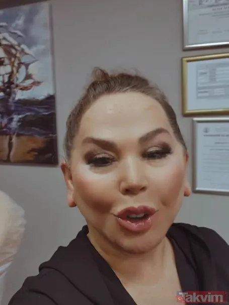 Safiye Soyman'ın son haline bakın "20 yıl geriye gittim genç kız gibi oldum" Seda Sayan'ın 'kobayı' Safiye estetikten sonra... - 11