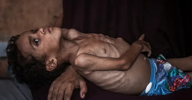 Gazze'de 122 kişi açlıktan öldü! İsrail hala kıtlık olmadığını iddia ediyor