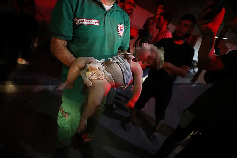 HER GÜN BAŞINDAN YA DA GÖĞSÜNDEN VURULAN ÇOCUKLAR!-3