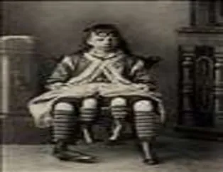 Tarihi Sirk ucubeleri