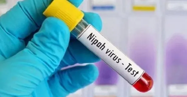 Hindistan’daki Nipah virüsü salgını büyüyor