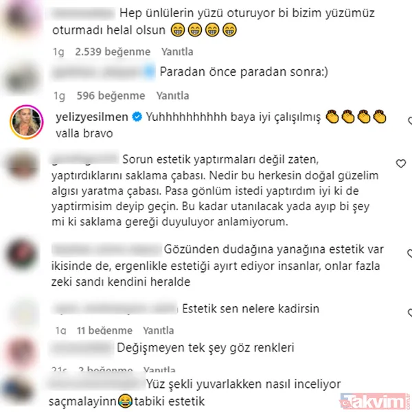 Hande Erçel ile Sıla Türkoğlu’nun o pozları ortalığı karıştırdı! İkisi de “Estetik yok” demişti! İlk yorum Yeliz Yeşilmen’den: Yuh baya iyi... - 6