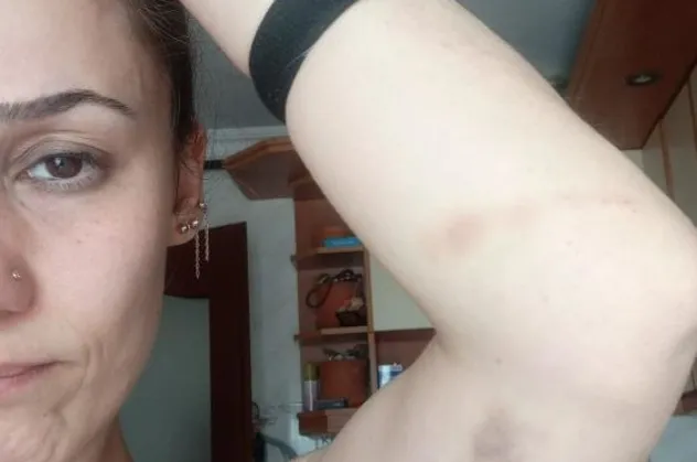 Genç kadına patronundan darp! Dehşet anlarını anlattı: Yapma anneme vurma