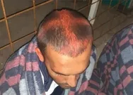 Hırvat polisinden ırkçı saldırı! Müslüman mültecilerin kafasına haç çizdiler