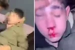 İşkenceli eğlencede 2 tutuklama! Sağır ve dilsiz çocuğun kulağını kesmeye çalışmışlardı