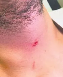 İstanbul Sarıyer'de skandal olay! 17 yaşındaki çocuğu okulda dövdüler-1