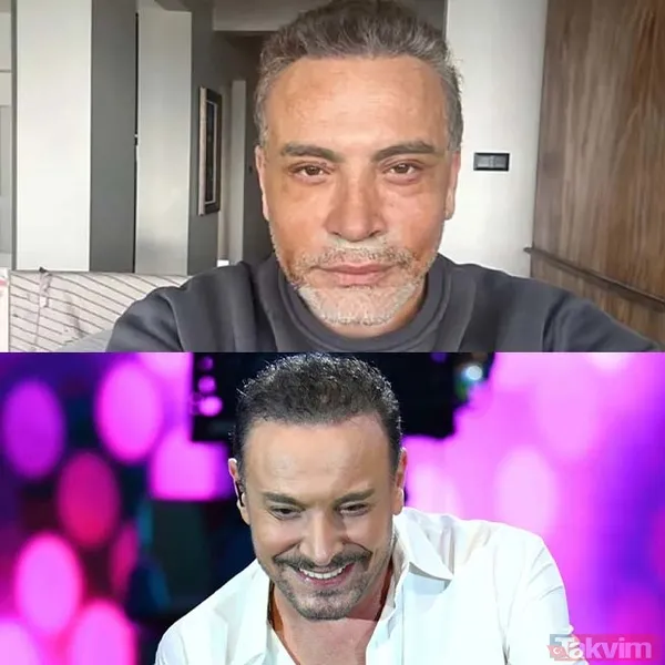 Alişan'dan botoks itirafı! İşte estetik yaptıran erkek ünlüler - 5