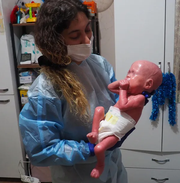 300-milyonda-bir-gorulen-yilan-hastaligi-harlequin-tipi-iktiyozis-ile-dogan-gokdeniz-bebek-1-yasinda-gunde-1-k-1644303243212.jpg 300 milyonda bir görülen yılan hastalığı (Harlequin tipi iktiyozis) ile doğan Gökdeniz Bebek 1 yaşında! Günde 1 kilo vazelin 2 tüp krem bitiyor-5