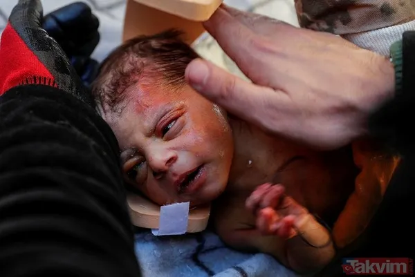 Türkiye bu hikayelere ağlıyor! Saatler sonra gelen mucizeler: Kimi sadece birkaç günlük kimi ise birkaç yaşında... - 3