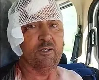 Antalya’da aslan dehşeti: Tarlada uyurken saldırdı, kulağını kopardı