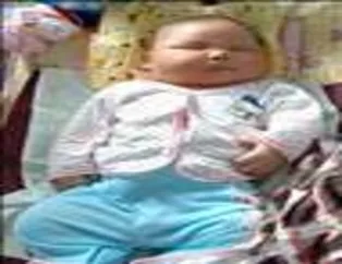 Doğuştan Sumocu Bebek!
