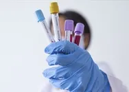 Koronavirüste rastgele test dönemi! Pilot şehir belli oldu