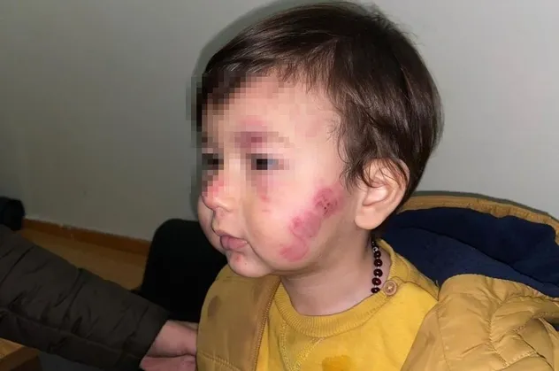 Kreşte dehşet anları! Akılalmaz ihmal: Dakikalarca sürdü