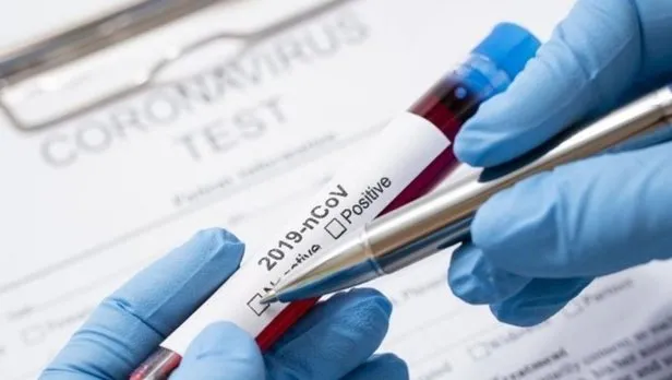 Covid 19 Test Sonucu Nasil Ogrenilir E Nabiz Covid 19 Test Sonucu Sorgulama Ekrani Takvim